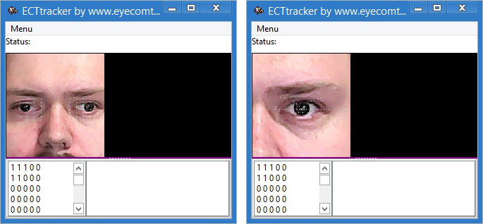 ECTtracker identifying structures for one and both eyes