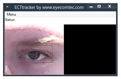 Location of source of light may significantly affect the contrast