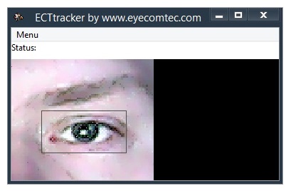 Location of source of light may significantly affect the contrast