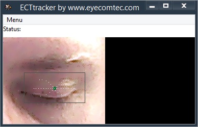 Using a contrast marker