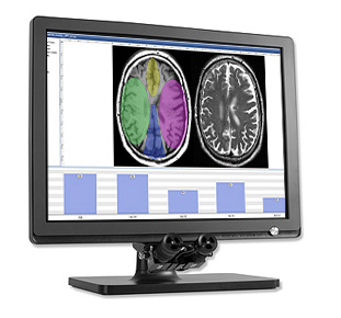 Binocular with monitor